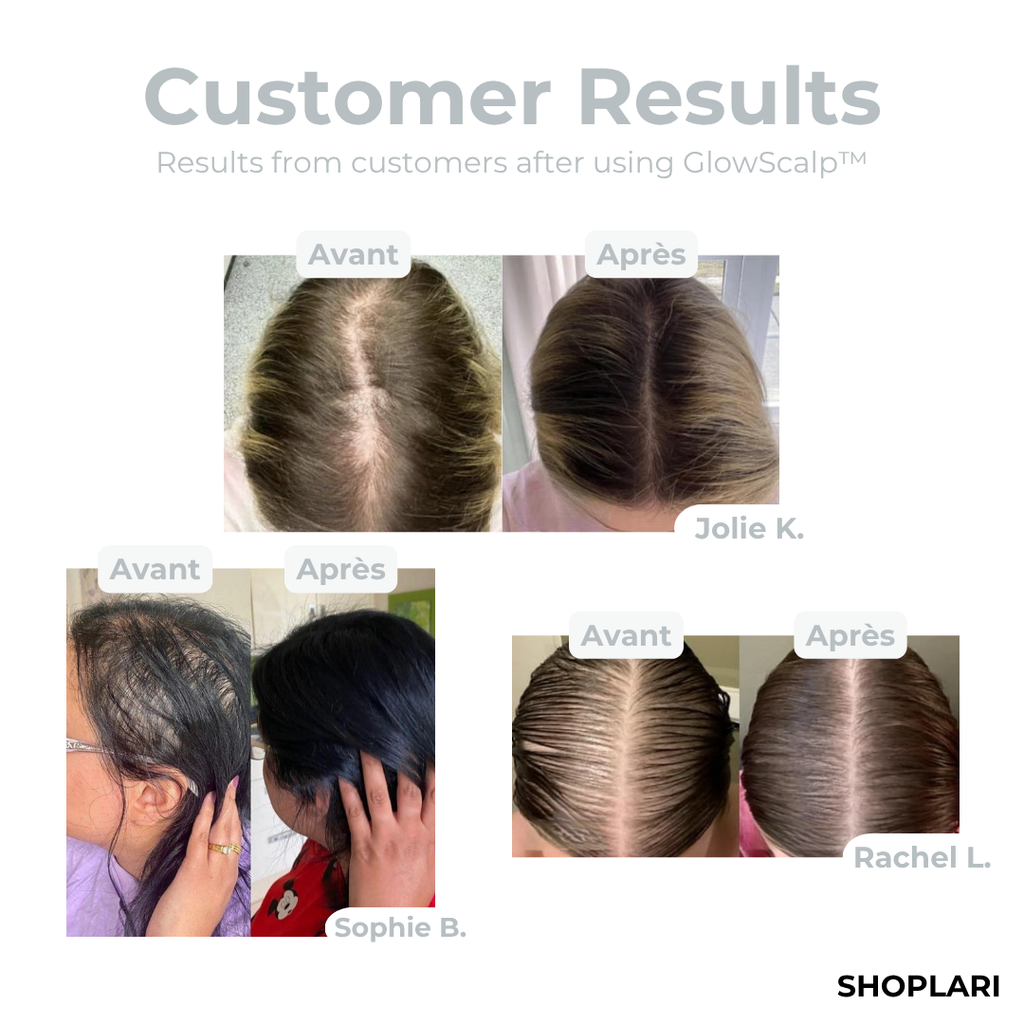 Letzter Tag 50% OFF | AuraScalp Pro™ – Lichttherapie für sichtbar stärkeres Haar