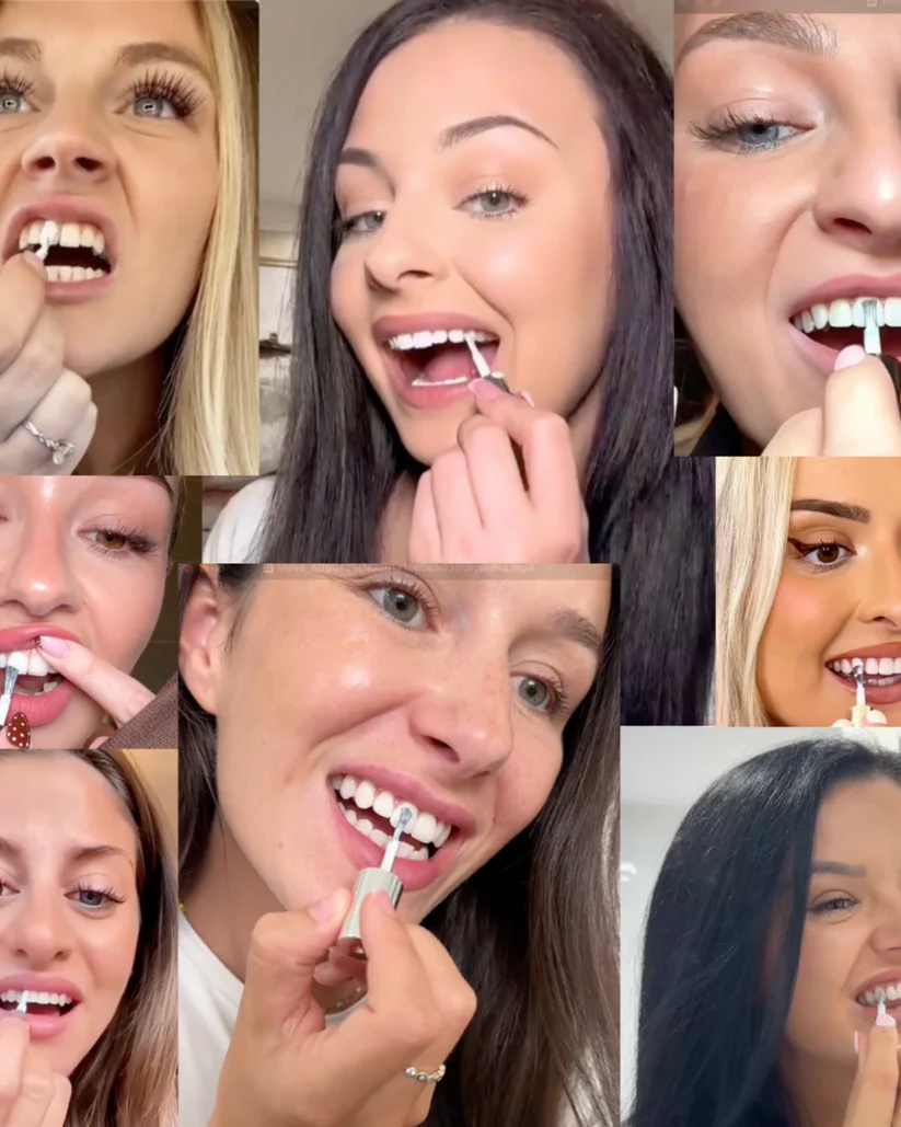GlowSmile Zahnaufhellungs-Gel – V34 Farbkorrektur für weißere Zähne (30 ml)
