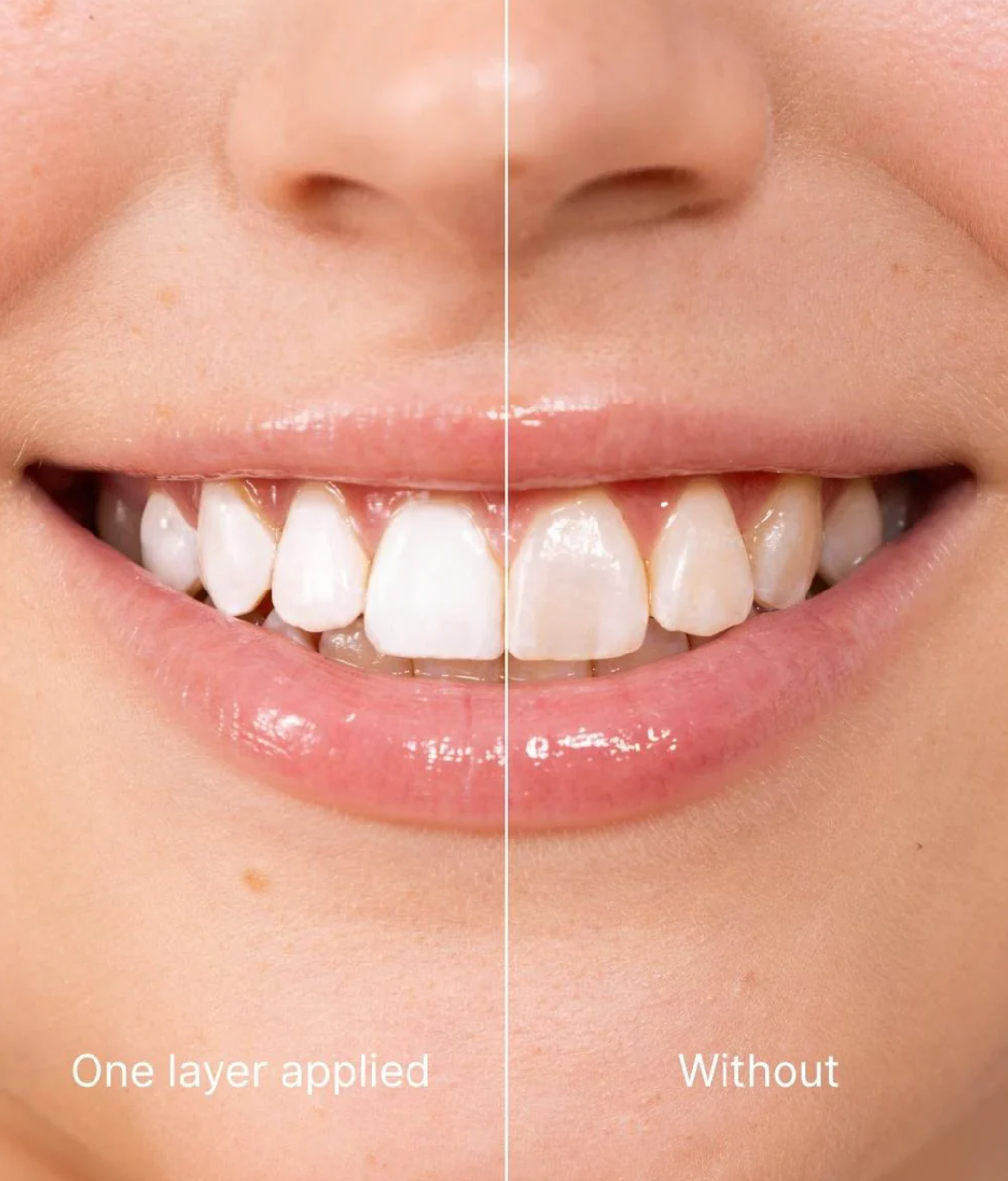 GlowSmile Zahnaufhellungs-Gel – V34 Farbkorrektur für weißere Zähne (30 ml)