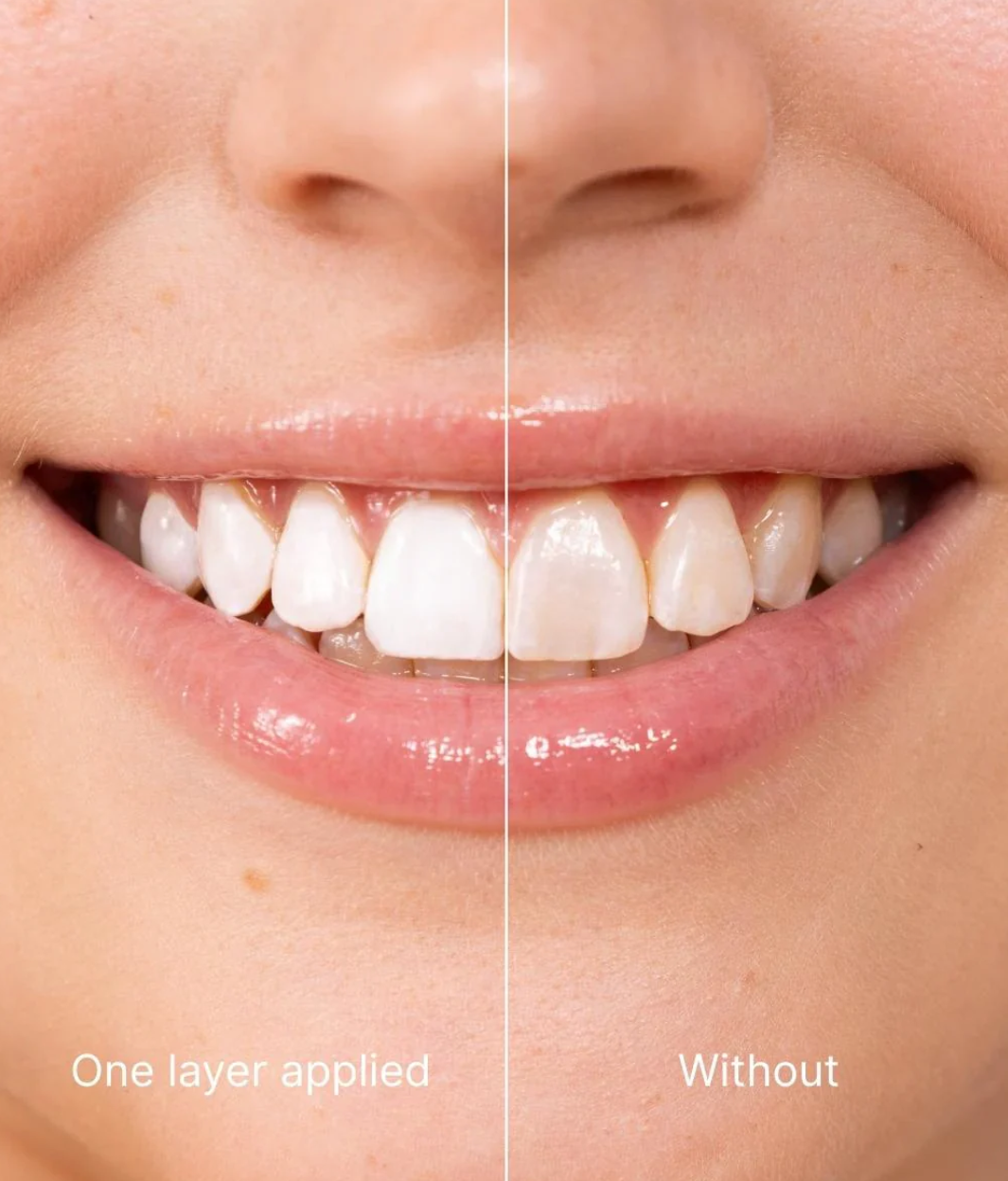GlowSmile Zahnaufhellungs-Gel – V34 Farbkorrektur für weißere Zähne (30 ml)