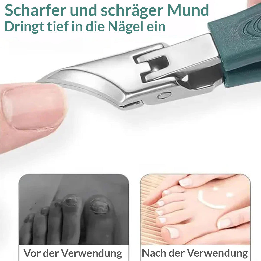 Nailcare™ - 3-teiliges. Nagelpflege-Set für eingewachsene Nägel [50% Rabatt]