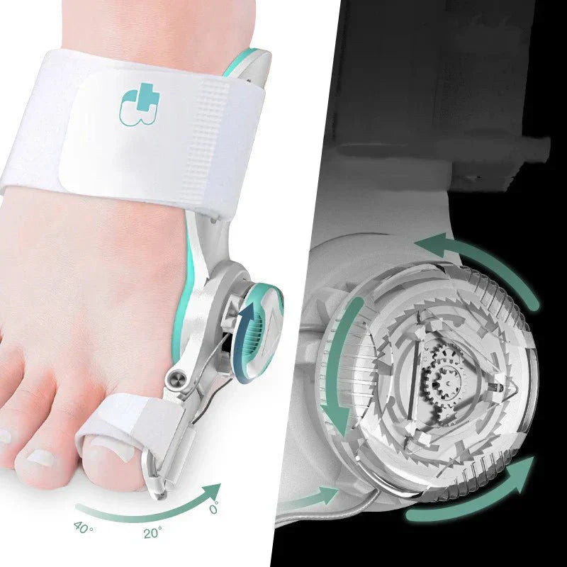 1+1 GRATIS | FlexiToe™ AlignCare – Sanfter Zehenkorrektor bei Hallux Valgus (Ballenzeh)