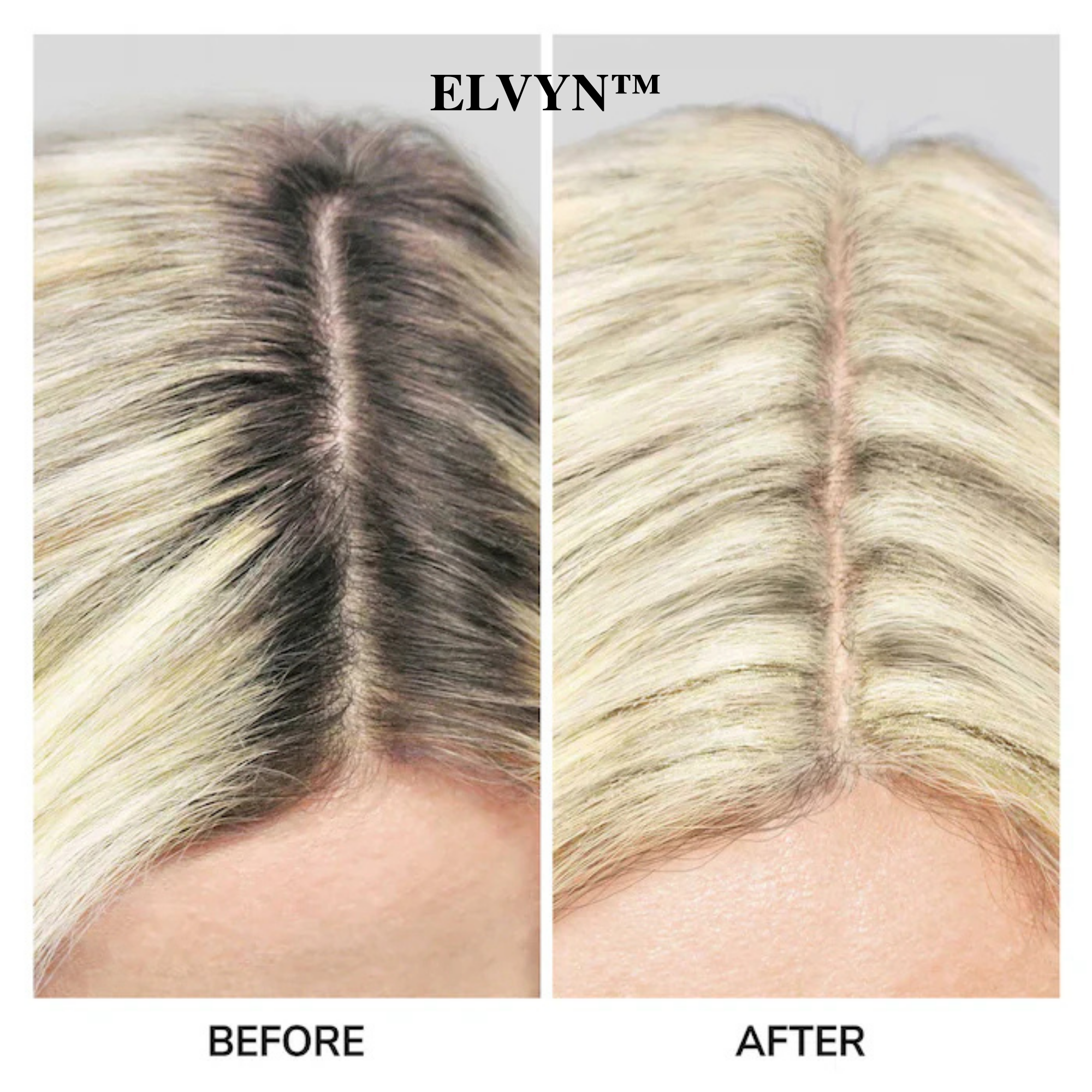 ELVYN™ Haarwurzel Retuschier-Puderpinsel