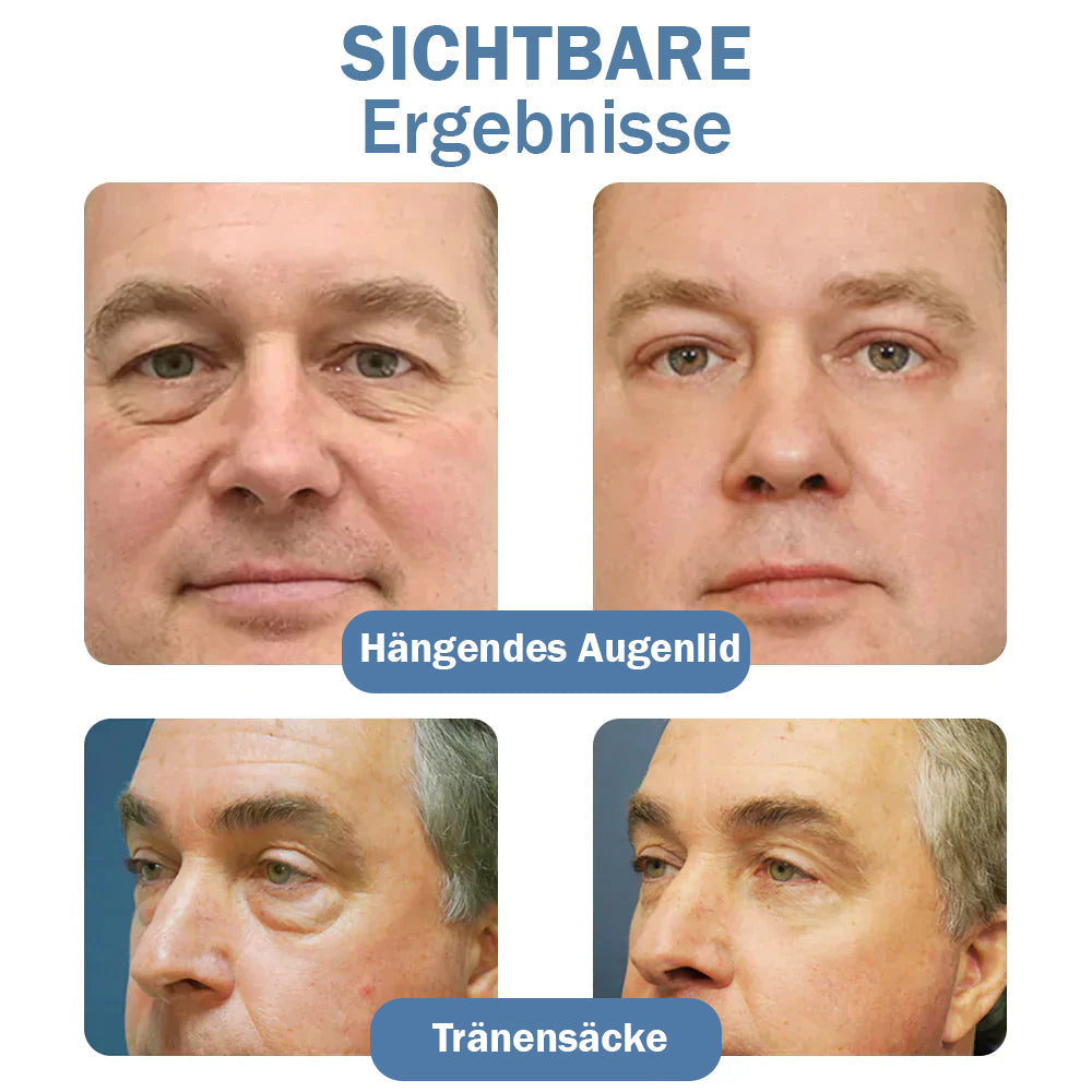 1+1 GRATIS | Augenpflege-Gel – Peptid & Koffein Augenserum für frische Augen