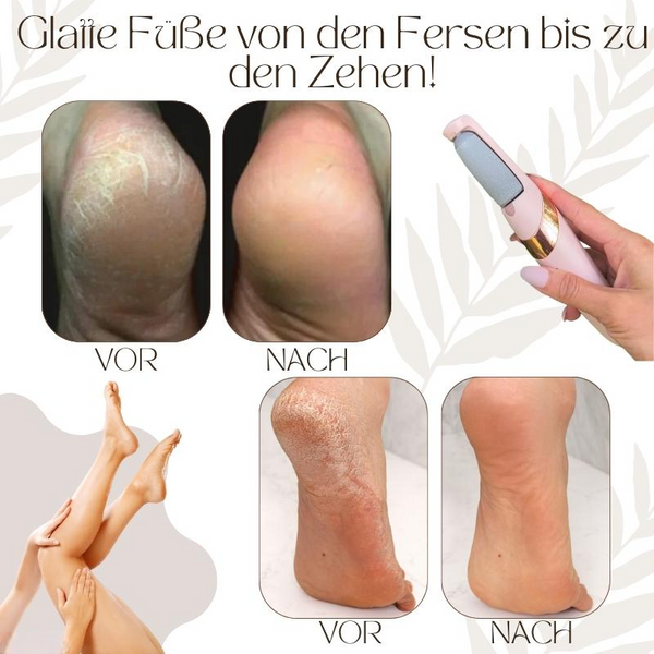 SoftRenew™ Profi-Fußglätter | Nur Heute 50% RABATT