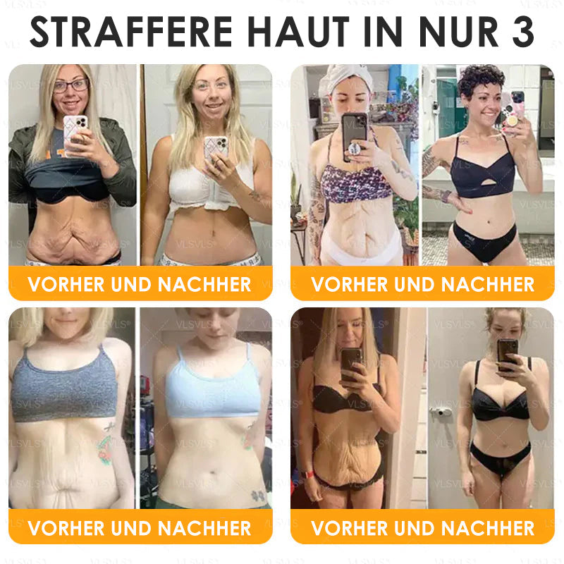 HealSkin™ – Straffende Anti-Aging-Creme mit Bienengift-Peptiden [1 + 1 Gratis]