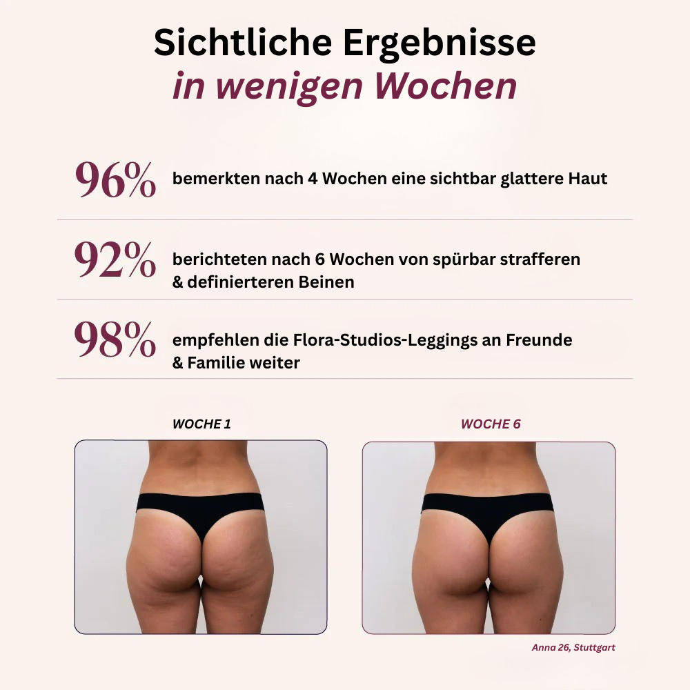 LumiForm™ SculptLeggings – 3D-Kompression für straffe Beine & eine feminine Silhouette