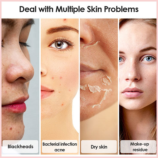 DermaLuxe ProClean™ – Spa-reine Haut in Minuten | 50% RABATT