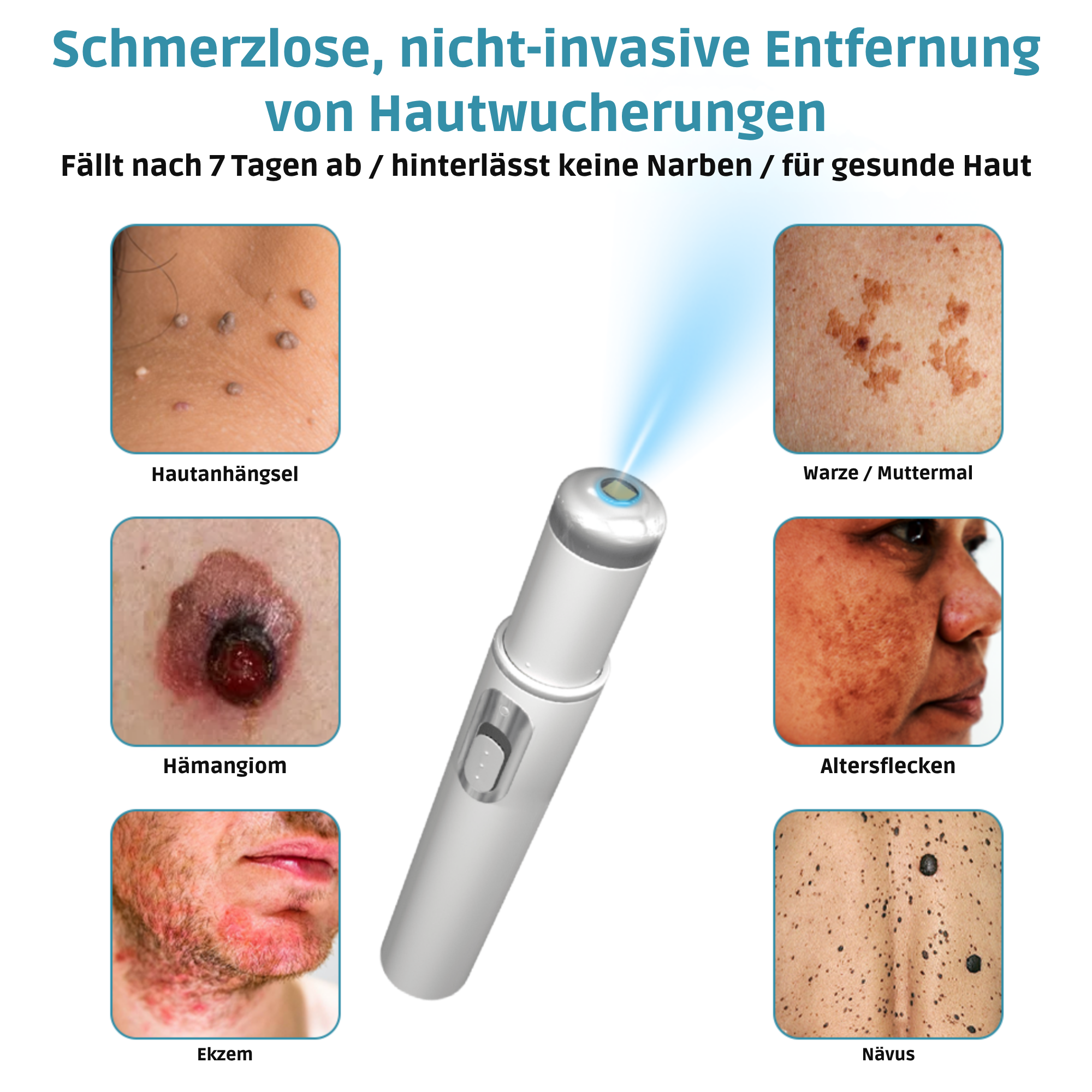 DermaLuxe™ ClearPen – Präzisions-Laserpen für ein ebenmäßiges Hautbild [50% RABATT]