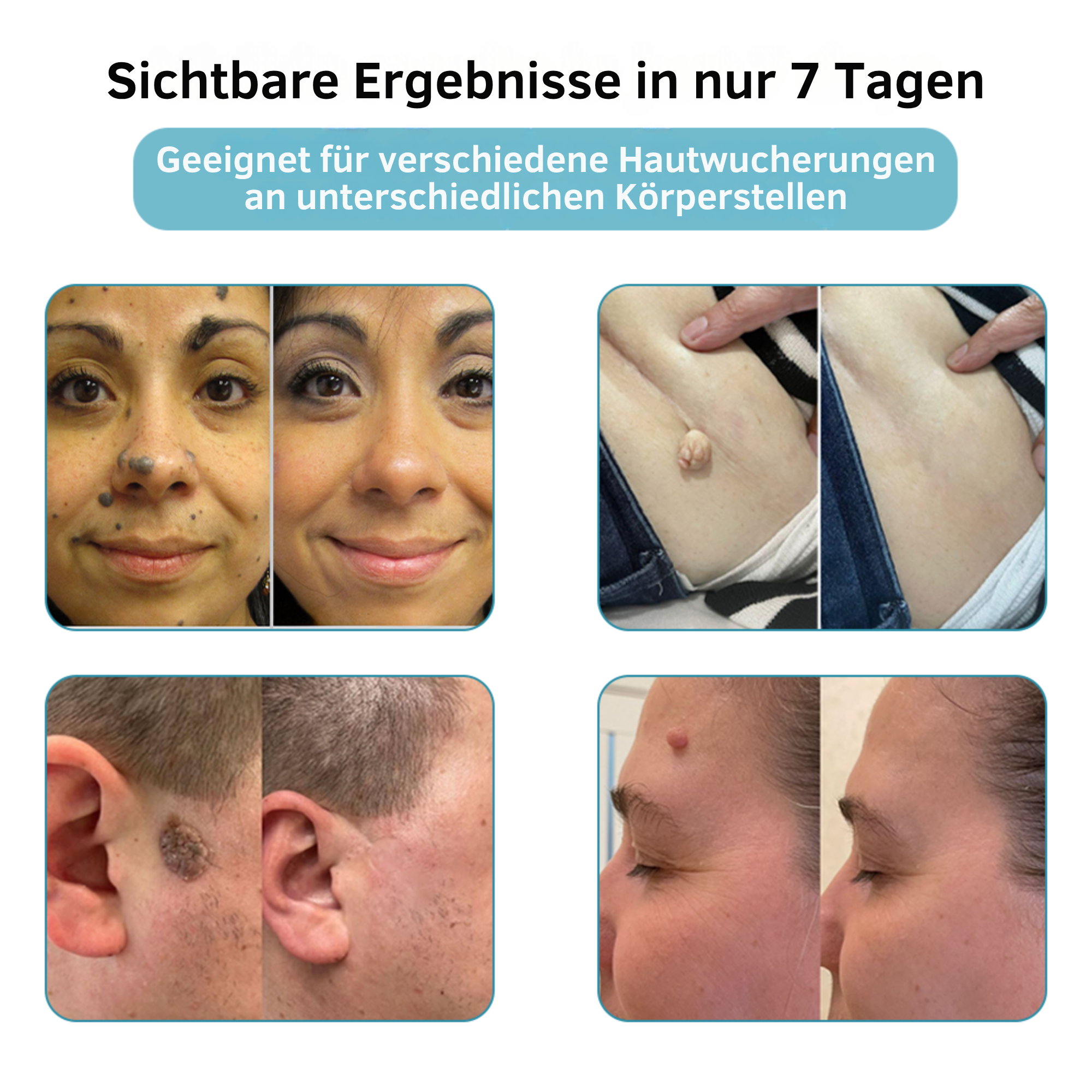 Klara™ – Erlebe jederzeit ebenmäßige, strahlende Haut und neues Selbstvertrauen [50% Rabatt]