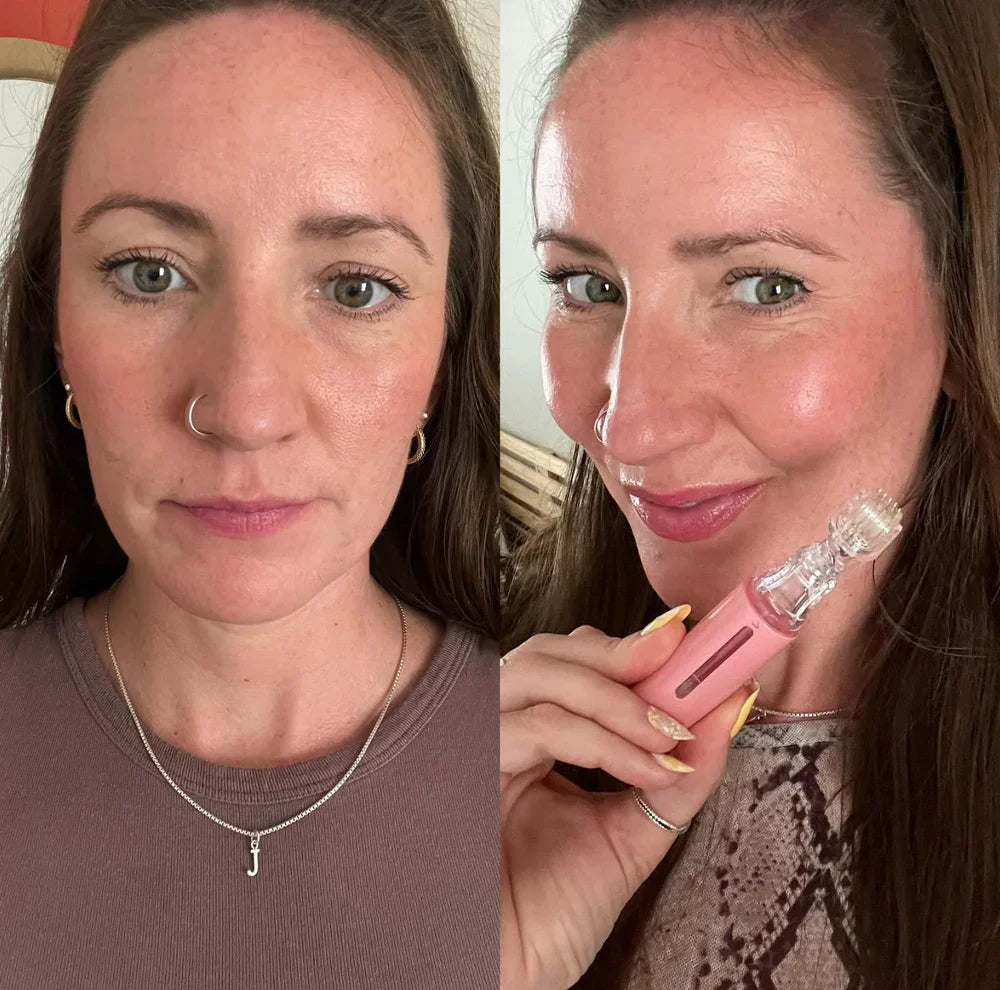 LipBoost Set – Sichtbar vollere Lippen in nur wenigen Wochen – ganz natürlich & ohne Spritzen.