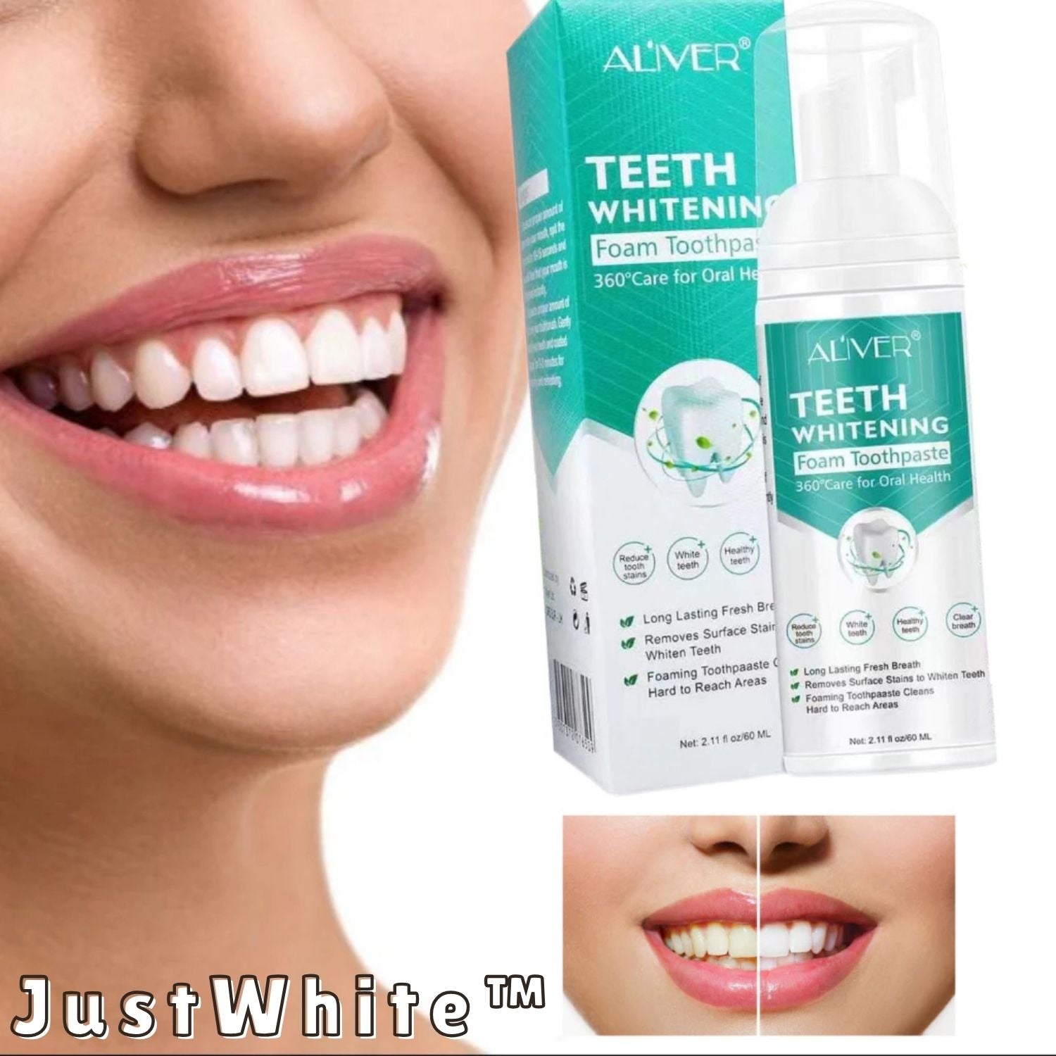 SmileFoam Clean – Aktivschaum für natürlich weiße Zähne & frischen Atem [1 + 1 Gratis]