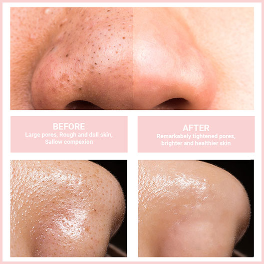 DermaLuxe ProClean™ – Spa-reine Haut in Minuten | 50% RABATT