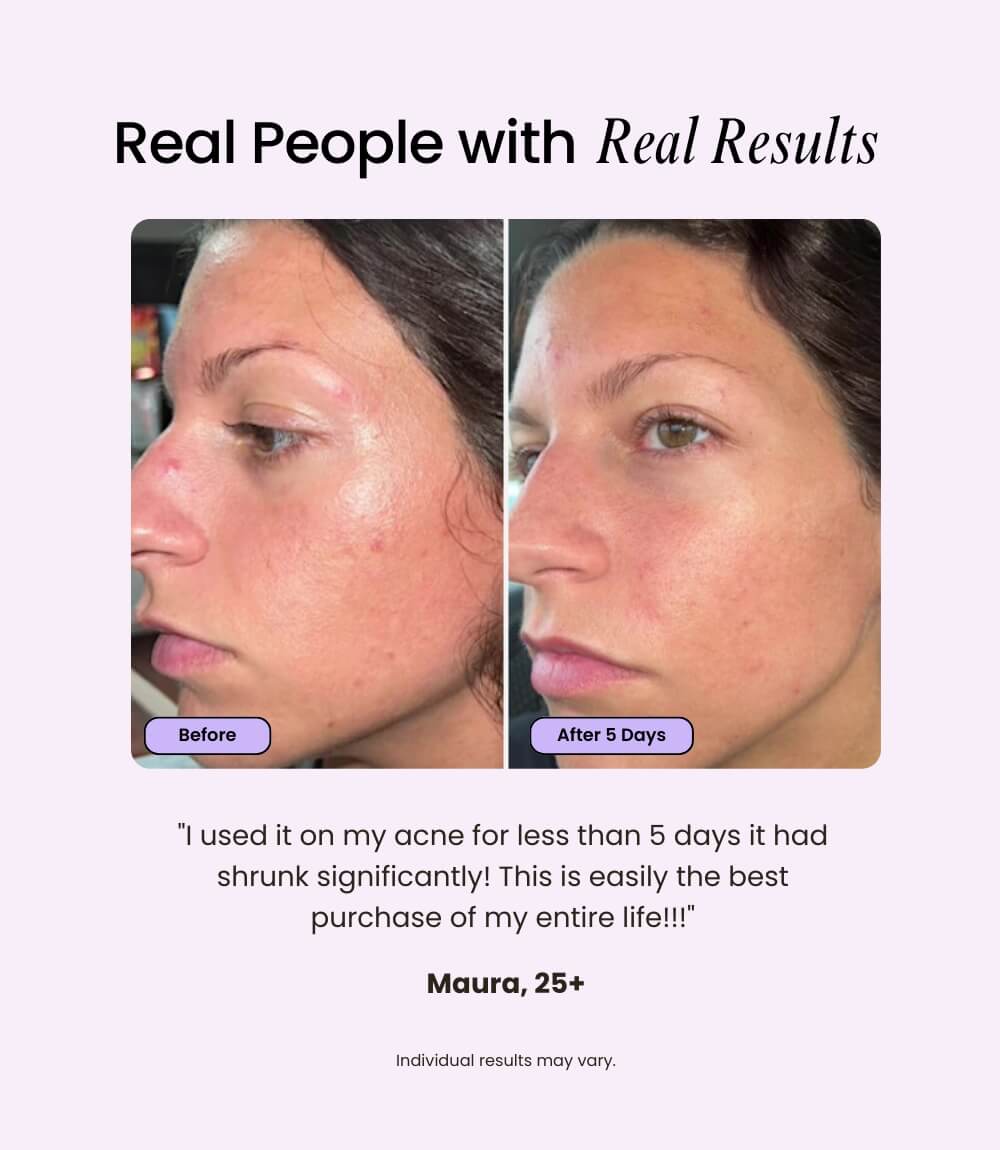 LUMÉA ONE™ – 5-in-1 Skin Renewal Wand