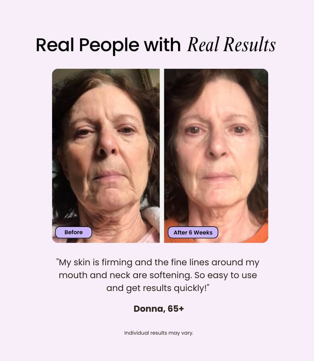 LUMÉA ONE™ – 5-in-1 Skin Renewal Wand