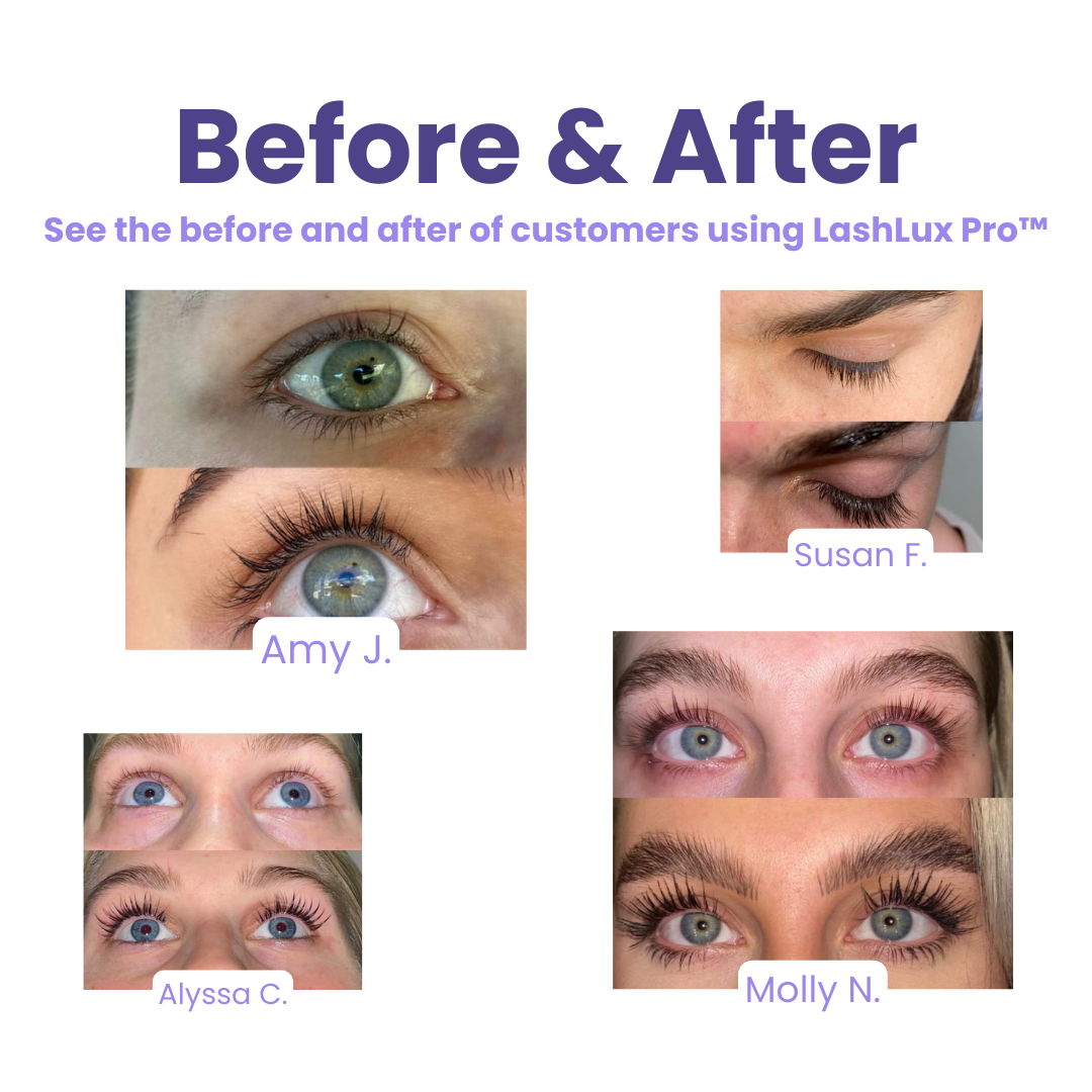 LashPro™ – Vollere Wimpern in 7 Tagen, ganz ohne Extensions