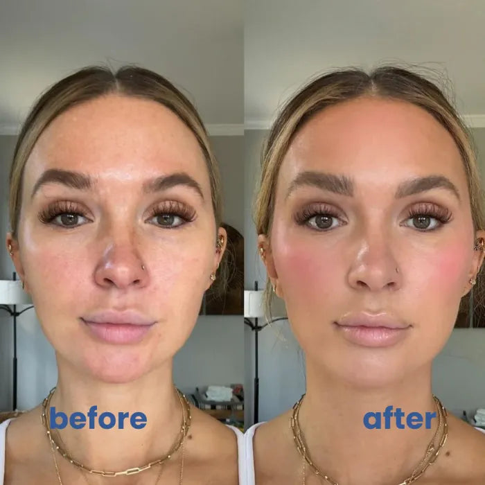 SkinMischung™ Neutralisiert sofortige Rötungen | 1+1 GRATIS