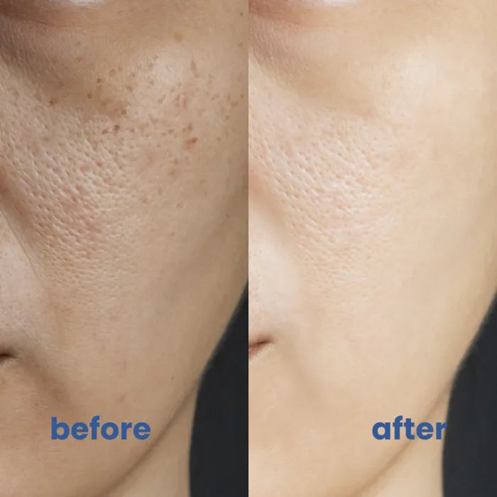 SkinMischung™ Neutralisiert sofortige Rötungen | 1+1 GRATIS
