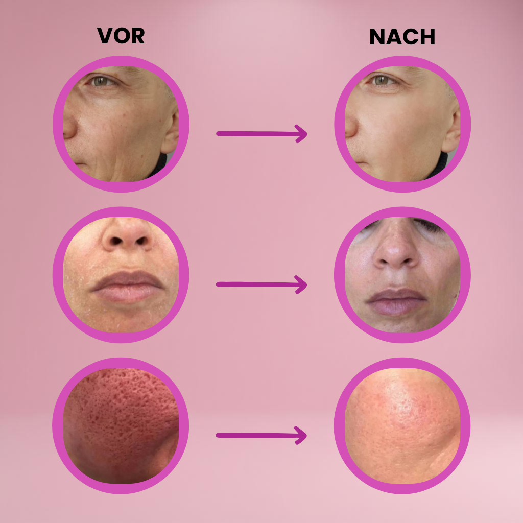 1+1 GRATIS | GlowLift MultiBalm Gesichtsbalsam – Sofort-Glättender Pflegebalsam für strahlende Haut